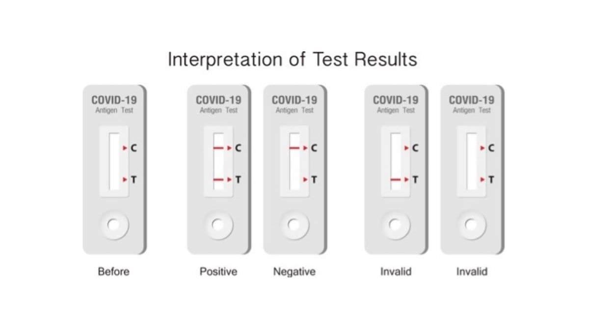 Clungene COVID-19 Antigen Rapid Test (Pack of 5) TGA APPROVED - RAT